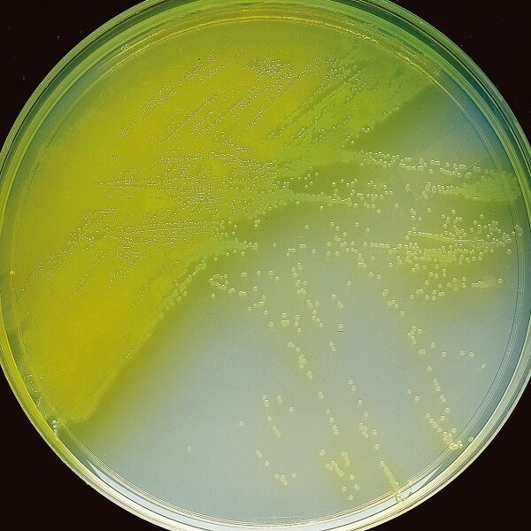 西三胺琼脂上的绿脓杆菌