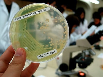 营养琼脂上的绿脓杆菌