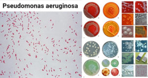假单胞菌铜绿假单胞菌