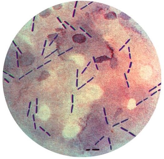 产气荚膜梭菌革兰氏染色-革兰氏阳性棒状