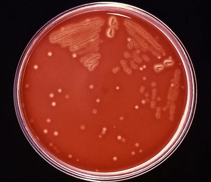 化脓性链球菌接种含5%去纤维羊血的胰蛋白酶大豆琼脂