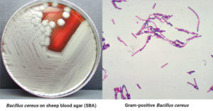 Bacillus-cereus-food-poisoning-with-foodborne-toxins