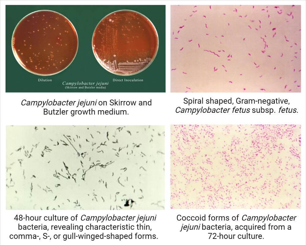 弯曲杆菌-形态和菌落特征