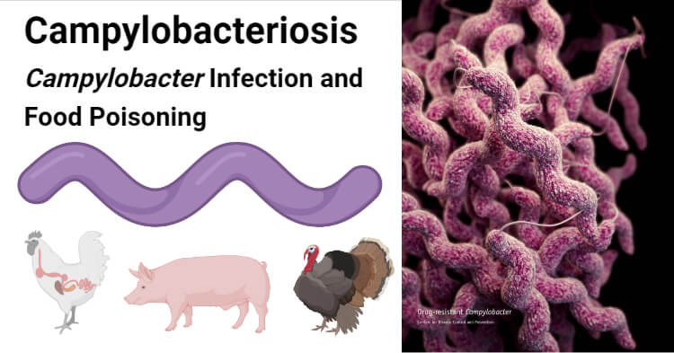 弯曲杆菌病-弯曲杆菌感染和食物中毒