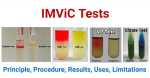 IMViC测试