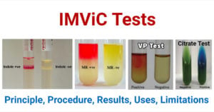 IMViC Tests