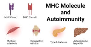 MHC分子与自身免疫举例