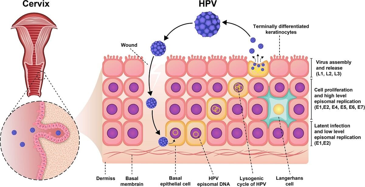 人乳头瘤病毒(HPV)的发病机制
