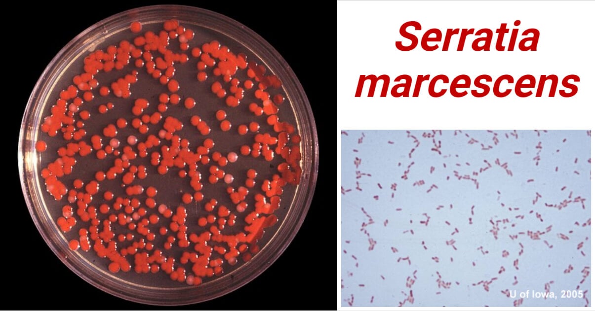 Serratia marcescens